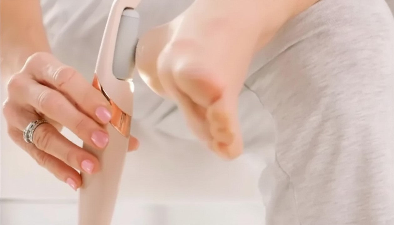 Foot Callus Remover