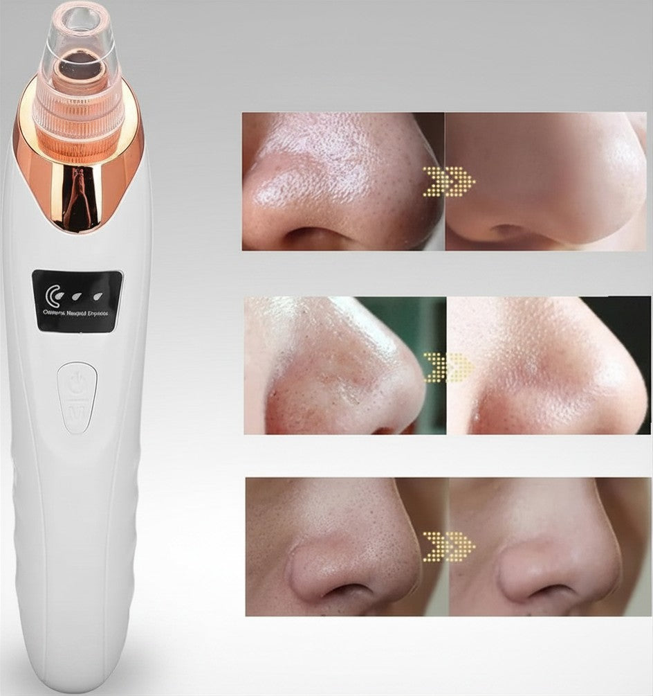Blackhead Vacuum